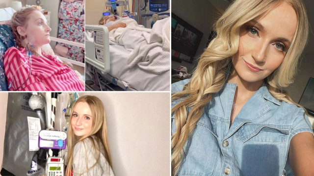 10 yıldır yemek yiyemiyor: ‘Kokusu bile rahatsız ediyor’ diyerek hastalığıyla nasıl mücadele ettiğini anlattı