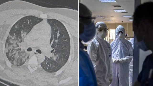 Dünya’da ve Türkiye’de ani genç ölümlerin sebebi nedir: Profesör Dr. Özkaya önemli açıklamalarda bulundu