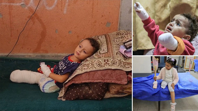 Çocukların bedeninde savaşın izleri: İsrail’in saldırıları sonucu Gazze’de yaklaşık 1000 çocuk uzuvlarını kaybetti