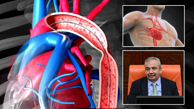 Sırrı Süreyya Önder aort damarı yırtıldı: Aort damarı nedir? Görevi yırtılma belirtileri ve tedavi yöntemleri nelerdir?