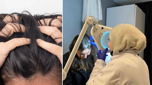 Bu maddelere dikkat: “Egzamanın gizli tetikleyicileri olabilir”