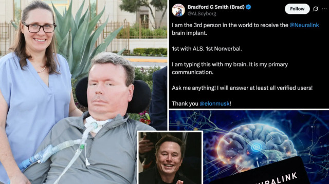 Dünyada bir ilk: Neuralink hastası beyin implantıyla ilk kez YouTube videosu hazırladı