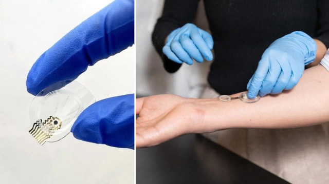 Enfeksiyonları günler öncesinden tespit eden akıllı bandaj: iCares