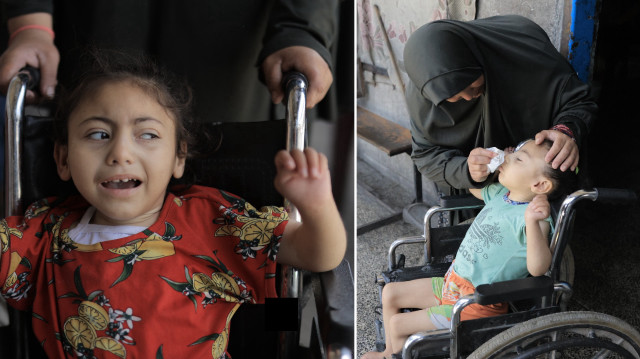 Gazze’de yetersiz beslenen 6 yaşındaki felçli Renda ölümün pençesinde