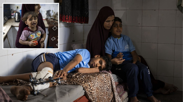 Gazze’de çocuk olmak: Hafızasını kaybetti kardeşi yürüyemez oldu