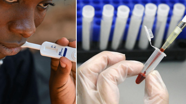 HIV tedavisinde tarihi adım: Virüs hücre içinde görünür hâle getirildi