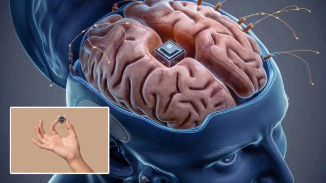 Neuralink’in yeni çipi ‘insanüstü yetenekler’ sağlayabilir