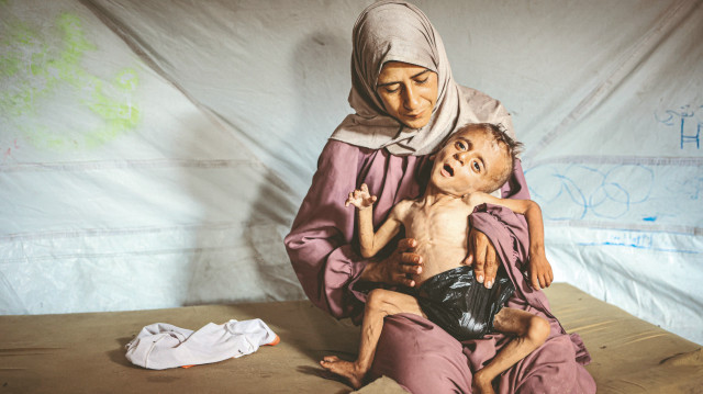 Açlıktan toplu ölümler kapıda