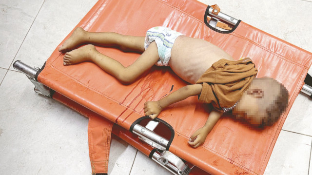 Ahmed de açlıktan öldü