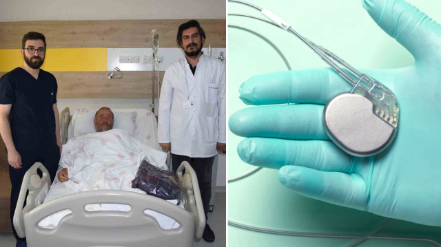 Bayburt’ta kalp yetersizliğiyle 4 senedir mücadele eden hastaya şoklama özelliği bulunan kalp pili takıldı