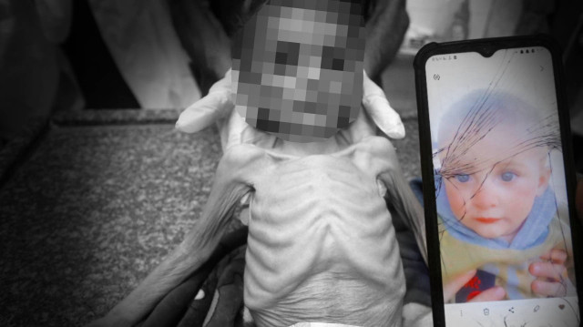 Bir bebek daha açlıktan hayatını kaybetti
