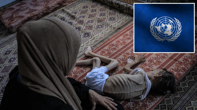 BM: Gazze’de çocuklar arasında akut yetersiz beslenme en yüksek seviyede