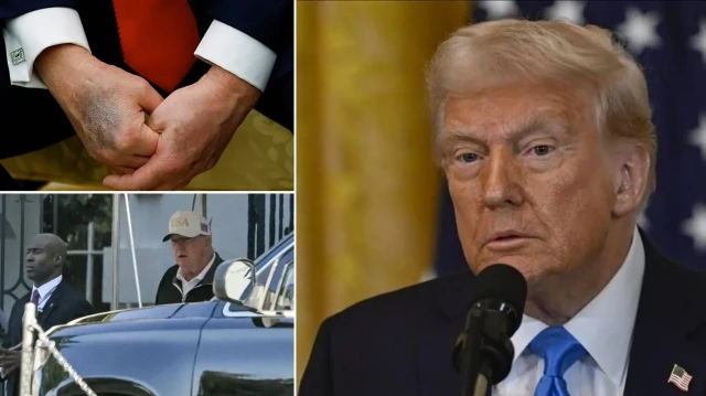 ‘Donald Trump öldü’ iddiaları sonrası açıklama: Günlerdir ortada yoktu ilk kez kamuoyu karşına çıkıyor