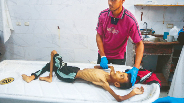 Dünya bir kutu mama gönderemiyor hepimiz öleceğiz