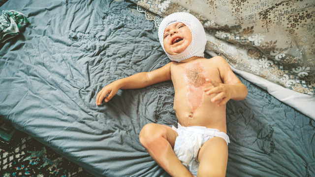 Gazze ‘felaketin ötesinde’