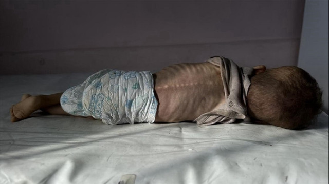 Gazze’de 2 yaşındaki bir bebek daha açlık nedeniyle hayatını kaybetti