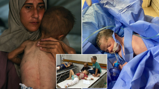 Gazze’de 40 binden fazla 1 yaş altı bebek yavaş yavaş ölüyor