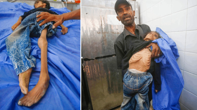 Gazze’de açlıktan ölen kız çocuğunun amcasından dünyaya sitem: Bir batı ülkesinde böyle bir şey olsaydı kıyamet kopardı