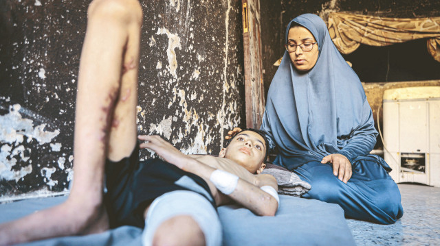 Her gün 30 kişi engelli oluyor