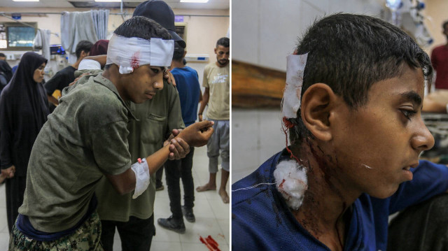 İsrail’in Gazze’ye saldırılarında can kaybı son 24 saatte 70 artarak 61 bin 897’ye çıktı