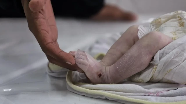 İsrail’in kıtlığa neden olduğu Gazze’de bir çocuk daha açlıktan hayatını kaybetti