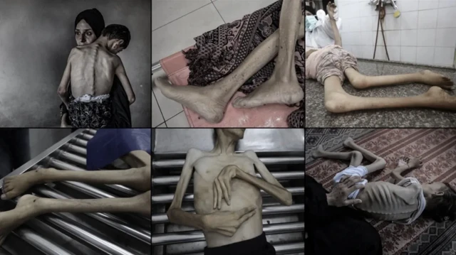 Katil İsrail’in kıtlığı dayattığı Gazze’de ağustos ayında 185 kişi açlıktan yaşamını yitirdi