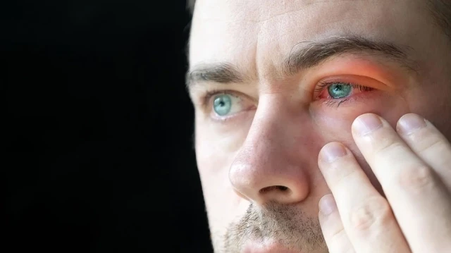 ‘Kırmızı göz’ riskine karşı deniz ve havuzda UV korumalı gözlük önerisi