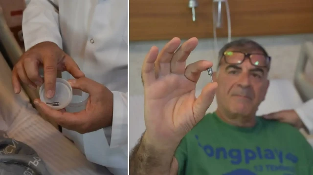 Öksürük şikayetiyle gitti: Akciğerinden diş implantı çıktı