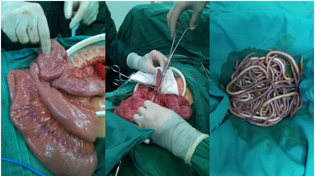 Ölümcül parazit alarmı: Vücuda sızıyor insanlarla besleniyor