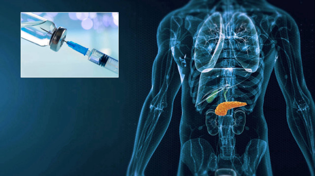 Pankreas kanserinde ‘olağanüstü aşı’ keşfedildi: Ömrü uzatıyor