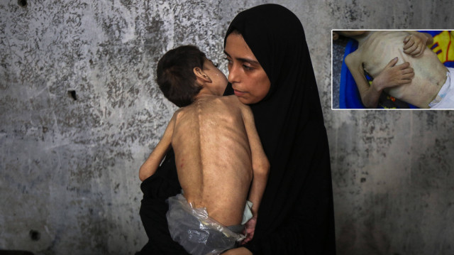 Sessiz kıyamet: Gazze’de son 24 saatte 2’si çocuk 6 kişi açlıktan yaşamını yitirdi