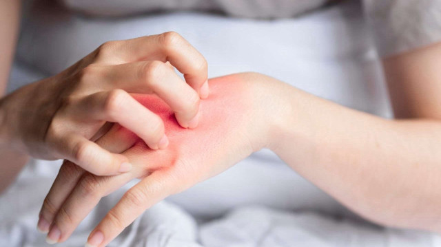 Sıcak ve nem mantar vakalarını artırıyor