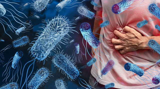 Uzmanlardan sıcak havalarda artan ‘Salmonella’ bakterisi uyarısı