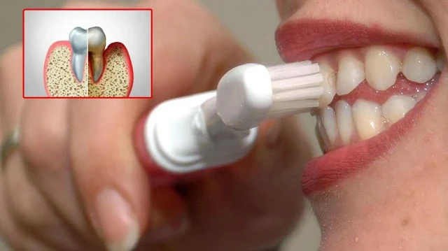 Ağız bakterileri kalp krizine yol açabilir