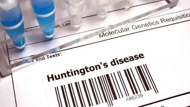 Huntington hastalığında tarihi gelişme: Yeni tedavi yüzde 75 yavaşlatıyor