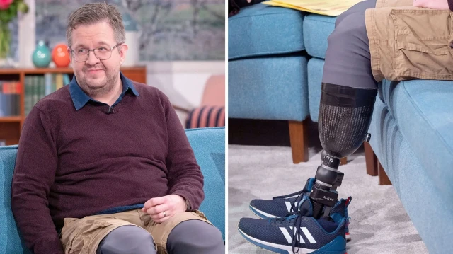 Kendi bacaklarını kesen cerrah dolandırıcılıktan hapse atıldı