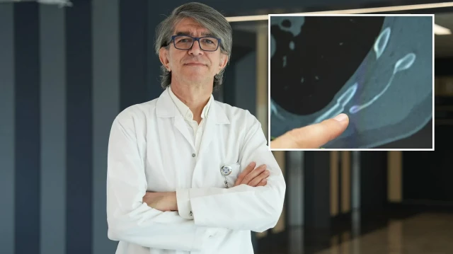 Uzman isim uyardı: Öksürürken kaburgalarınız kırılabilir