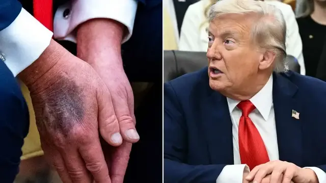 Trump’ın kalp yaşı 65 çıktı