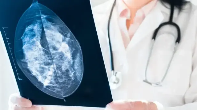 Uzmanlar 40 yaşından sonra her kadına mamografi takibi öneriyor