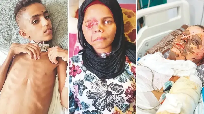 Bu çocukları acilen kurtarmalıyız