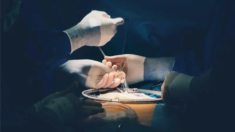 Kapalı yöntem mitral kapak onarımıyla kalp gücü artan hastalar yaşam konforunu artırıyor