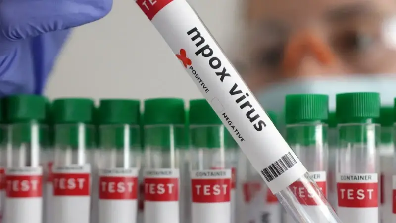 Gana’da bir haftada 19 yeni M çiçeği vakası görüldü