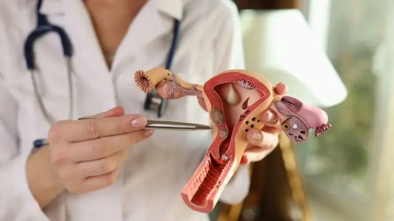 İhmal edilen ‘endometriozis’ kadınlarda o sorunlara neden olabiliyor