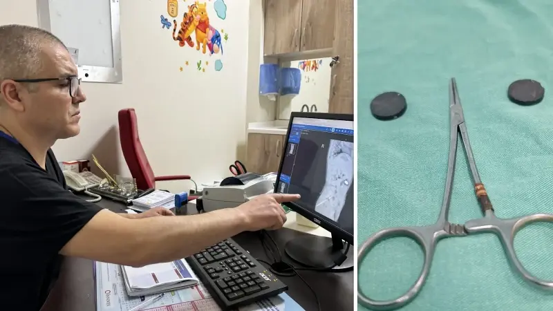 Karaman’da tuvaletini yapamayan çocuğun bağırsağından iki mıknatıs çıkarıldı