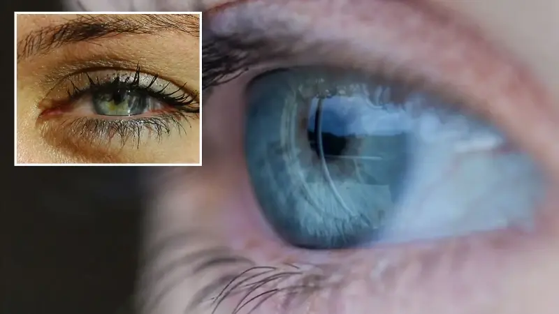 Sağlık Bakanlığı: 2025’te 750 bin kişiye glokom tanısı konuldu