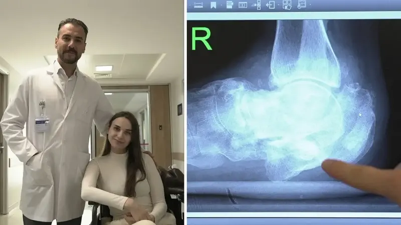 Sırbistan’da ‘ayağın kesilecek dediler’: Türkiye’de yeniden yürüdü