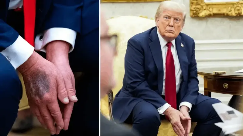 Beyaz Saray, Trump’ın hastaneye kaldırıldığı yönündeki sosyal medya iddialarını yalanladı